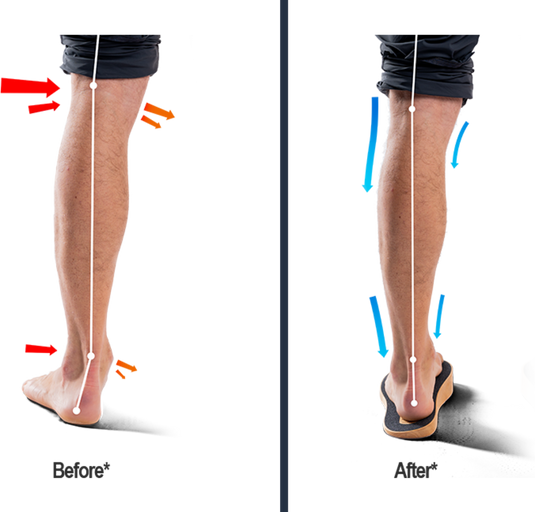 1/2 Pc Men Women Calf Leg Thigh Support Varicose Veins Knee Brace